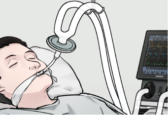 M-режим, анатомический M-режим (AMM)