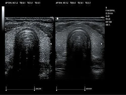 Адаптивная пространственная фильтрация изображений — zonClear
