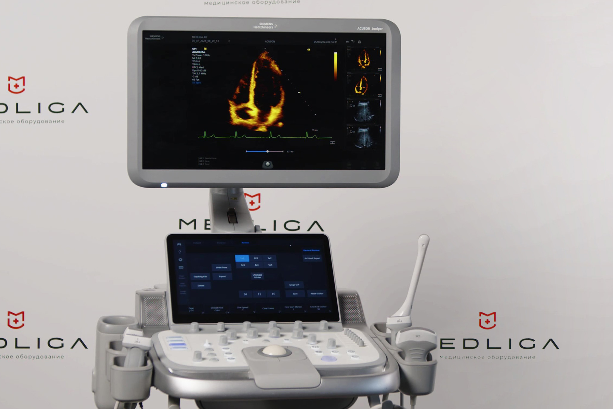 Видеообзор УЗ аппарата Siemens Juniper