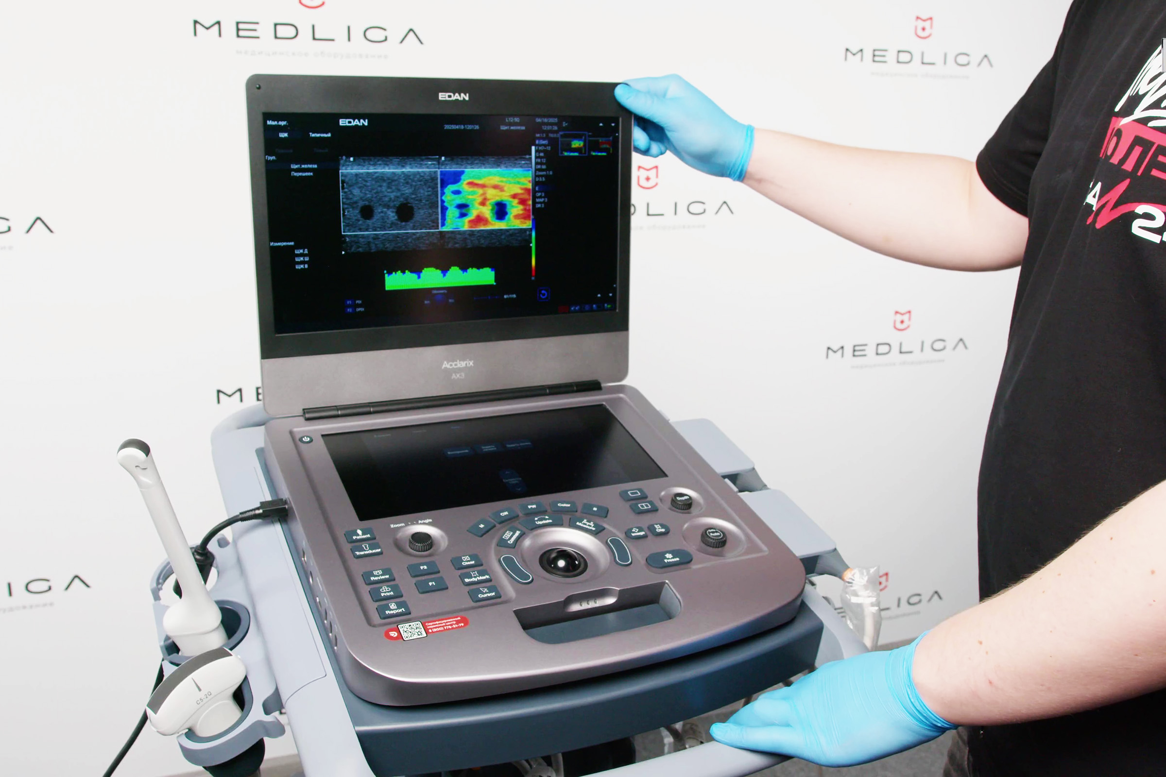 EDAN Acclarix AX3: технологии УЗИ для рутинной работы врачей