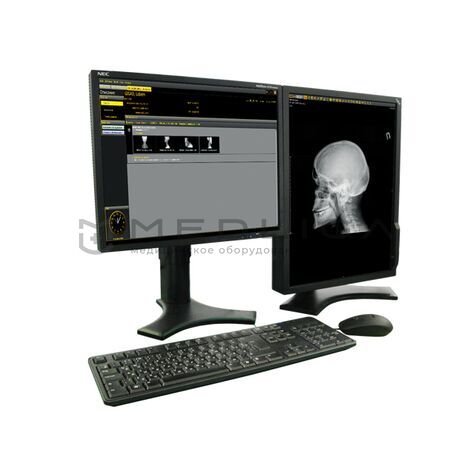 МТЛ «УнивеРС-Флюорограф-МТ», Мощность генератора, кВт: 32, 3