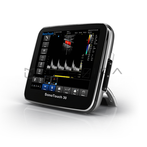 CHISON SonoTouch 30 (ECO 3), 2