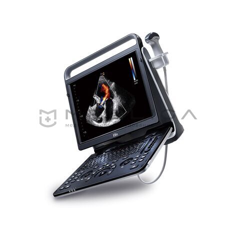 Chison SonoTouch 60, 2