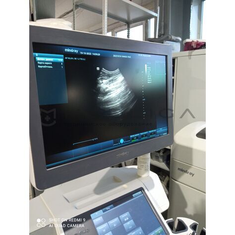 Mindray C5-2E (БУ, 2021), Серийный номер: VST18089926, 5