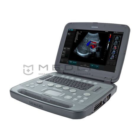 Siemens Acuson P500