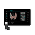Smart Thyroid
